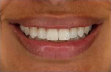 Reference for photo 1: Smile
